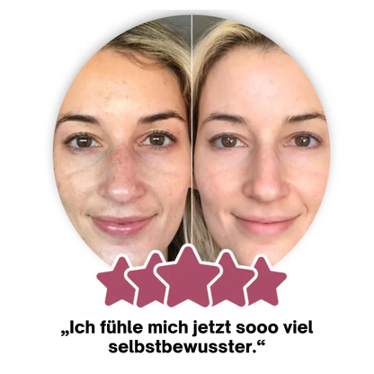Glow Reinheits Pads
