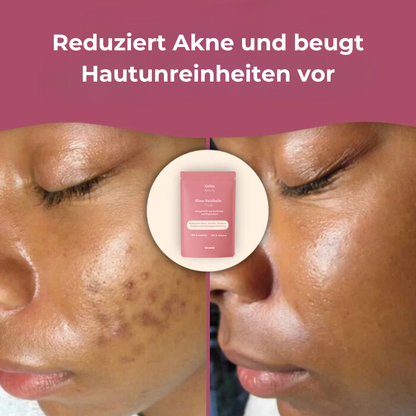 Glow Reinheits Pads