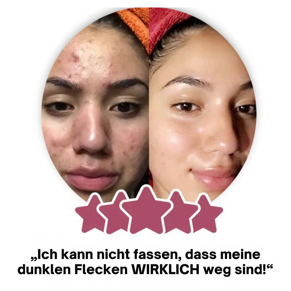 Glow Reinheits Pads