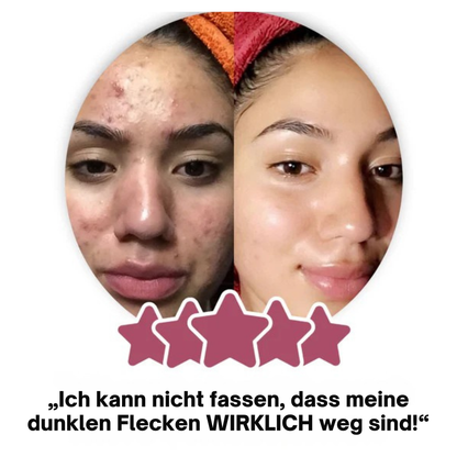 Glow Reinheits Pads